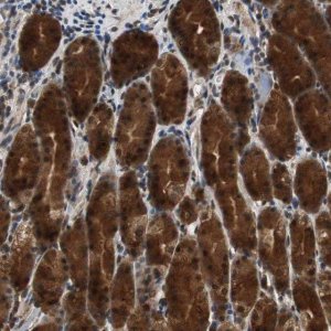 Anti-ZNF18 antibody produced in rabbit 
