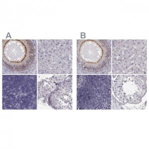 Anti-ZNF185 antibody produced in rabbit 