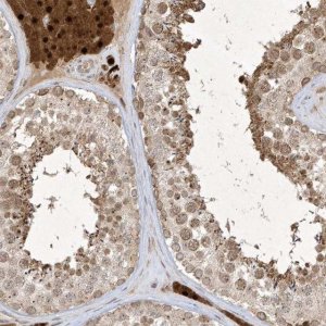 Anti-ZNF213 antibody produced in rabbit 