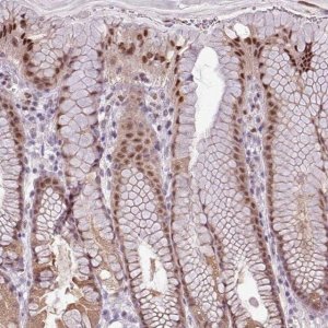 Anti-ZNF217 antibody produced in rabbit 