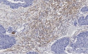 Anti-Zyxin Antibody, clone 2F17 ZooMAb Rabbit Monoclonal 