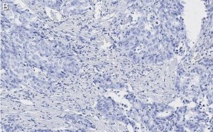 Anti-Zyxin Antibody, clone 2F17 ZooMAb Rabbit Monoclonal 