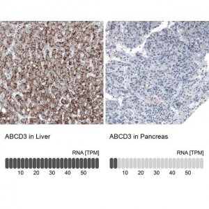 Monoclonal Anti-ABCD3 antibody produced in mouse 
