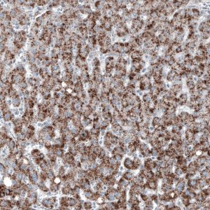 Monoclonal Anti-ABCD3 antibody produced in mouse 