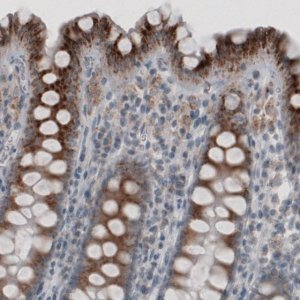 Monoclonal Anti-ACAA1 antibody produced in mouse 