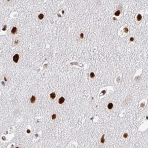 Monoclonal Anti-ADAR antibody produced in mouse 