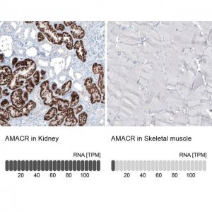 Monoclonal Anti-AMACR antibody produced in mouse AMAB91561-100UL