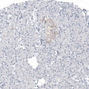 Monoclonal Anti-AMACR antibody produced in mouse AMAB91561-100UL