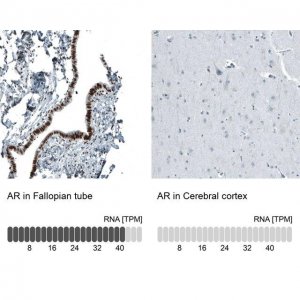 Monoclonal Anti-AR antibody produced in mouse AMAB91547-100UL