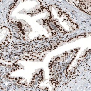 Monoclonal Anti-AR antibody produced in mouse AMAB91547-100UL