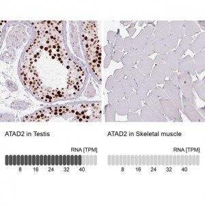 Monoclonal Anti-ATAD2 antibody produced in mouse 