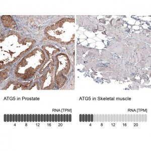 Monoclonal Anti-ATG5 antibody produced in mouse AMAB91582-100UL