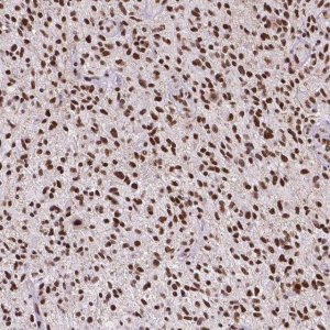 Monoclonal Anti-ATRX antibody produced in mouse 