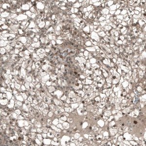 Monoclonal Anti-CDK2 antibody produced in mouse AMAB91497-100UL