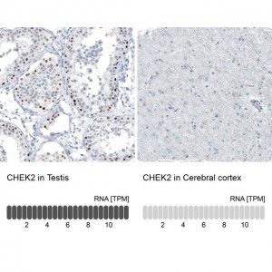 Monoclonal Anti-CHEK2 antibody produced in mouse AMAB91570-100UL