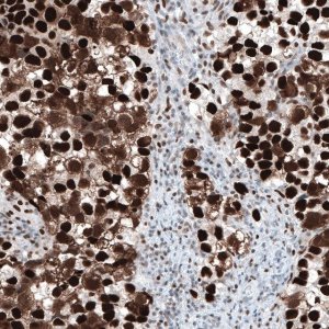 Monoclonal Anti-CHEK2 antibody produced in mouse AMAB91570-100UL