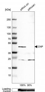 Monoclonal Anti-CNP antibody produced in mouse 