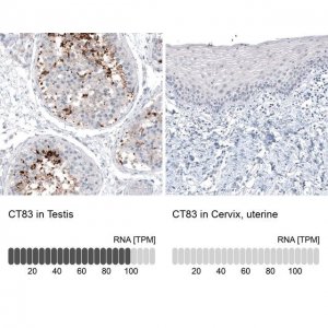 Monoclonal Anti-CT83 antibody produced in mouse 