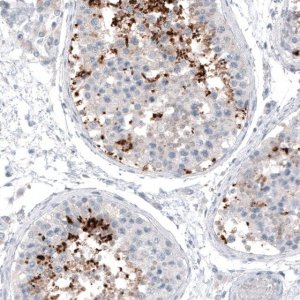 Monoclonal Anti-CT83 antibody produced in mouse 