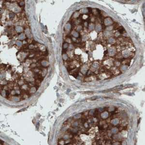 Monoclonal Anti-DIAPH2 antibody produced in mouse 