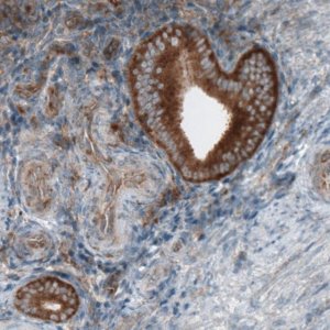 Monoclonal Anti-DICER1 antibody produced in mouse 