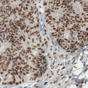 Monoclonal Anti-ERCC1 antibody produced in mouse 
