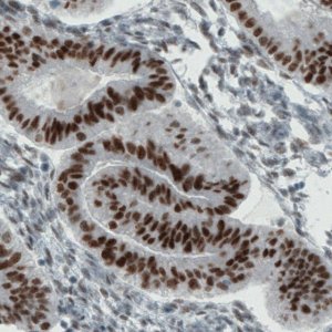 Monoclonal Anti-ESR1 antibody produced in mouse 