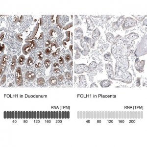 Monoclonal Anti-FOLH1 antibody produced in mouse AMAB91551-100UL