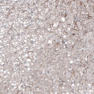 Monoclonal Anti-FOLH1 antibody produced in mouse AMAB91551-100UL