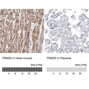 Monoclonal Anti-FRMD5 antibody produced in mouse AMAB91580-100UL