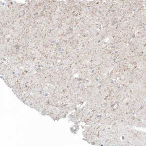 Monoclonal Anti-FRMD5 antibody produced in mouse AMAB91580-100UL