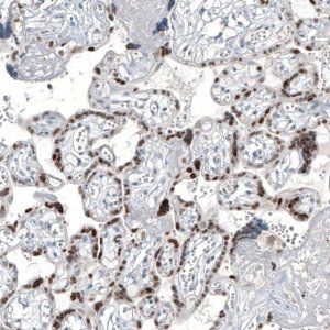 Monoclonal Anti-GATA3 antibody produced in mouse AMAB91525-100UL