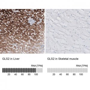 Monoclonal Anti-GLS2 antibody produced in mouse AMAB91483-100UL