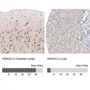 Monoclonal Anti-HDAC5 antibody produced in mouse AMAB91501-100UL