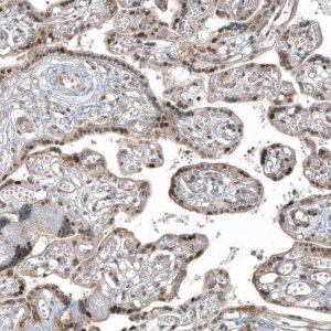 Monoclonal Anti-HDAC5 antibody produced in mouse AMAB91501-100UL
