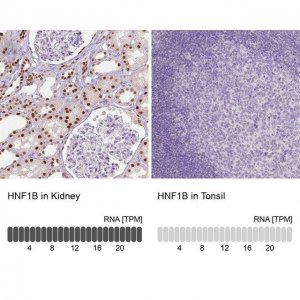 Monoclonal Anti-HNF1B antibody produced in mouse 