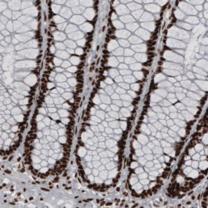 Monoclonal Anti-HNRNPC antibody produced in mouse 