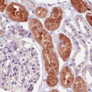 Monoclonal Anti-IDH1 antibody produced in mouse 