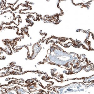 Monoclonal Anti-ITGA8 antibody produced in mouse 
