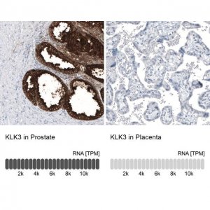 Monoclonal Anti-KLK3 antibody produced in mouse AMAB91567-100UL