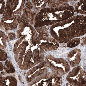 Monoclonal Anti-KLK3 antibody produced in mouse AMAB91567-100UL