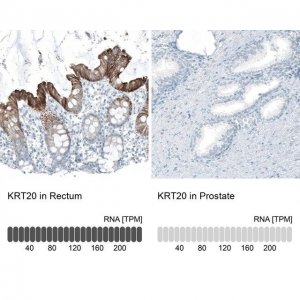 Monoclonal Anti-KRT20 antibody produced in mouse AMAB91564-100UL
