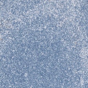 Monoclonal Anti-KRT20 antibody produced in mouse AMAB91564-100UL