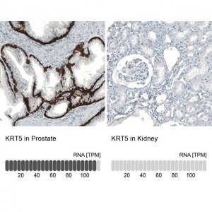 Monoclonal Anti-KRT5 antibody produced in mouse AMAB91549-100UL