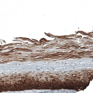 Monoclonal Anti-KRT5 antibody produced in mouse AMAB91549-100UL