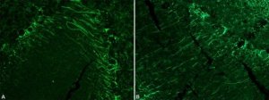 Monoclonal Anti-Neurofilament 200 antibody produced in mouse 