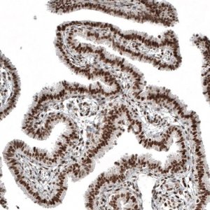 Monoclonal Anti-NFKB2 antibody produced in mouse AMAB91511-100UL