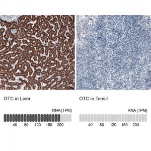 Monoclonal Anti-OTC antibody produced in mouse 