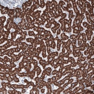 Monoclonal Anti-OTC antibody produced in mouse 