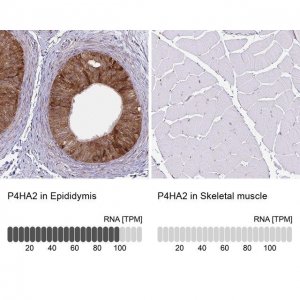 Monoclonal Anti-P4HA2 antibody produced in mouse 